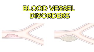 Blood Vessel Disorders 🩸 [upl. by Eimmaj760]