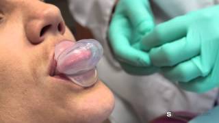 What is a tongue retaining device for sleep apnea  Dr Susan M Welch [upl. by Elvyn]