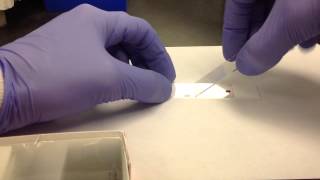 Hematology Making a Peripheral Blood Smear [upl. by Homer82]