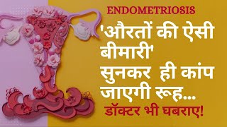 Endometriosis in Hindi औरतों की ऐसी बीमारी कि सुनकर कांप जाएगी रूह  Symptoms Treatment Diet Tips [upl. by Alleira]