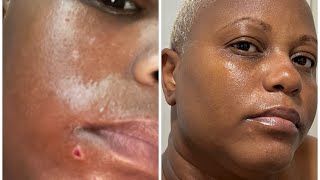 GLO Melanin Product Review Part 1 July 16th 2024 [upl. by Jala]