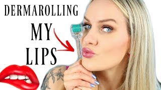 How to Get PLUMP  SOFTER Lips with DERMAROLLER [upl. by Gula495]