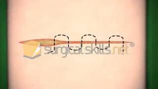 Subcuticular suture animation [upl. by Hanahs]