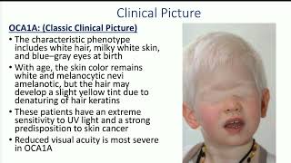 4 Congenital hypomelanosis by Dr Mohamed Aidaros [upl. by Ecirtram]