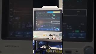 ECG minutes after euthanasia  Veterinary Video [upl. by Yerhpmuh]