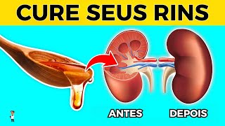 Nenhum Paciente Renal Perderá Um Rim Novamente Assista a Isso [upl. by Syck483]