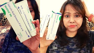 My 1 Month Experience  Salicylic Acid Ointment IP 6  SALICYLIX SF6 [upl. by Crosley973]