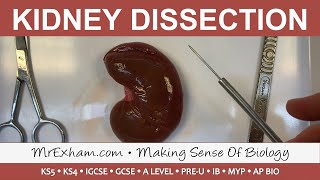 Anatomy of the Kidneys Part 1 [upl. by Euqinahs]