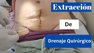 Extracción de Drenaje  Drainage Surgery [upl. by Yvad]