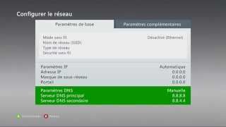 Explication et réglage des DNS sur Xbox [upl. by Cranford]