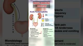 Acute pyelonephritis symptoms  Acute pyelonephritis Management [upl. by Lehctim949]