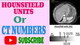 Lec 5  HOUNSFIELD UNITS or CT NUMBERS  Computed Tomography Physics [upl. by Guglielmo]