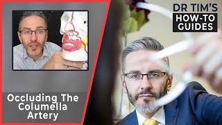 How To Reduce The Risk Of Occluding The Columella Artery [upl. by Naitsabes]