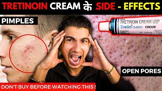 How to Apply Tretinoin Cream I Tretinoin Journey I Tretinoin Side Effects [upl. by Afatsom]