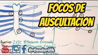 Focos de auscultación cardiaco facil y sencillo [upl. by Leehar]