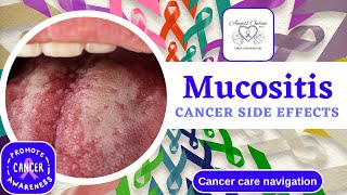 Understanding Mucositis A Side Effect from Cancer Treatment  Symptoms Management amp Home Remedies [upl. by Screens916]