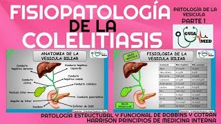 COLELITIASIS FISIOPATOLOGÍA GuiaMed [upl. by Iny438]