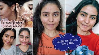 Night time Skincare for PostAcne Scars amp Marks  Kashika Chauhan [upl. by Ciredor798]