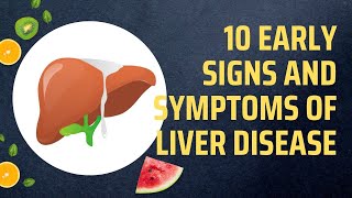 10 Early Signs And Symptoms Of Liver Disease [upl. by Dowdell765]