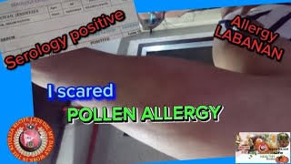 Red patchesAllergy Attack labanan Immune system theoreticalserology3rdstag36 [upl. by Akehsay]