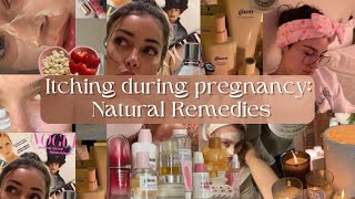 ITCHING during pregnancy  2 natural remedies to get rid of it [upl. by Grefe]