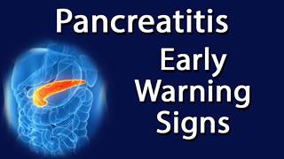 Pancreatitis  Early Warning Signs [upl. by Eilarol840]