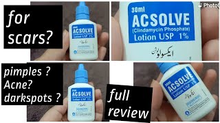 ACSOLVE lotion Review [upl. by Awhsoj674]