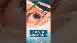 Want To Get Rid Of Glasses Get Specs Removal Surgery At EyeMantra [upl. by Marlon]