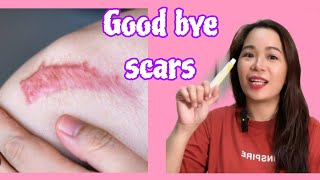 Scar remover Update Contractubex gel [upl. by Adiraf]