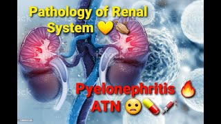 Renal Pathology  Pyelonephritis  Acute tubular necrosis 🤍💪🏻 [upl. by Uhayile271]