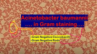 Acinetobacter baumannii in Gram Staining of Culture [upl. by Lucas]