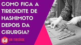 Como fica a Tireoidite de Hashimoto após a tireoidectomia [upl. by Xxam]