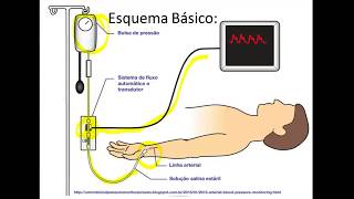 PAI Pressão Arterial Invasiva parte 1 [upl. by Eniledam]