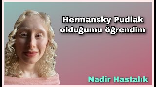 Hermansky Pudlak Sendrom Tip 1 Olduğumu Öğrendim  Hermansky Pudlak Syndrome￼ albinism HPS [upl. by Hairim89]