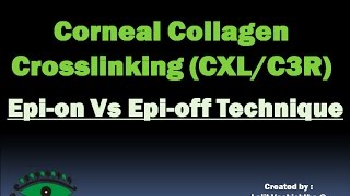 CORNEAL COLLAGEN CROSSLINKING EPION Vs EPIOFF TECHNIQUE HD [upl. by Ettenot]