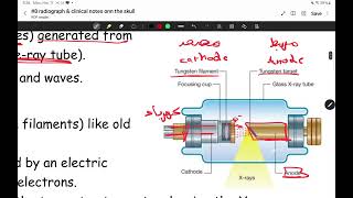 head amp neck anatomy II lecture 8 radiography and clinical notes on skull II majed rumman [upl. by Almeda]