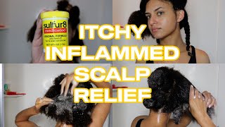 SULFUR 8 amp WATER SAVED MY ITCHY SCALP  Seborrheic Dermatitis Relief  Wash Day Routine ASMR [upl. by Ahsekam]