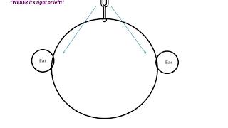 Two Point Discrimination Tests [upl. by Rexana]