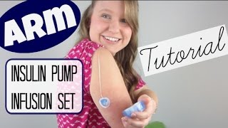 ARM Insulin Pump Infusion Set Tutorial [upl. by Iak]