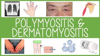 Polymyositis and Dermatomyositis in 3 Minutes [upl. by Etnoek450]