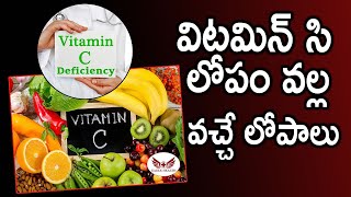 Vitamin C Deficiency Telugu I విటమిన్ సి లోపం I Vitamin C deficiency Symptoms [upl. by Cooe]