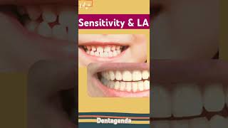 Sensitivity amp local anesthesia [upl. by Mainis251]