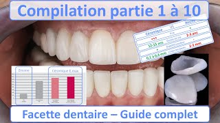 Facette dentaire  Guide complet  Compilation partie 1 à 10 [upl. by Aeduj]