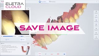 ELETRA SMART Intraoral Scanner Training  Save Image  Digital Dentistry [upl. by Chelton]