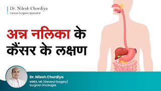 अन्न नलिका के कैंसर के लक्षण  Esophageal cancer symptoms  Food pipe cancer Hindi  Dr Nilesh [upl. by Hseyaj]