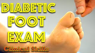 Diabetic Foot Examination  Clinical Skills  Dr Gill [upl. by Enyale]