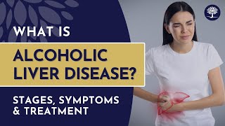 Alcoholic Liver Disease Stages Symptoms and Treatment alcoholaddiction alcoholfacts [upl. by Weidner]