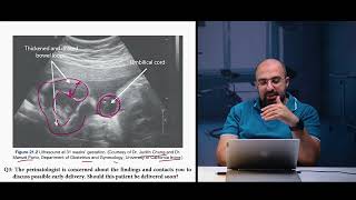 Ep 94 Gastroschisis8 case study CS amp premature deliveryDr Khaled Salah gastroschisis premature [upl. by Evania]