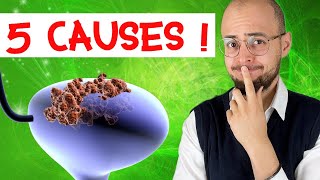 CANCER de la VESSIE  5 grandes causes [upl. by Riddle]