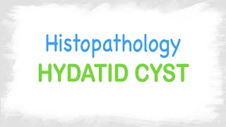 Hydatid Cyst histopathology features [upl. by Nika733]